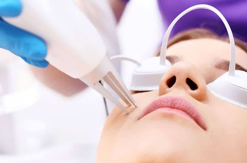 Clear skin acne treatment procedure at Shrinika Derma Care, specialized in dermatology and skin care solutions for healthy, radiant skin.